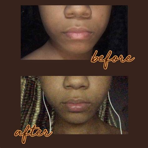 subliminal results pictures|results ::.::. ♡ compiled face results w/pics .